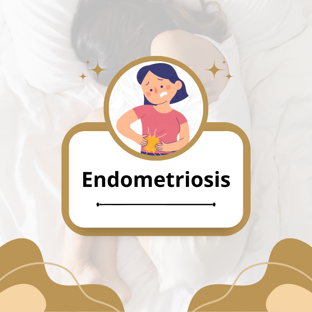 Endometriosis.png