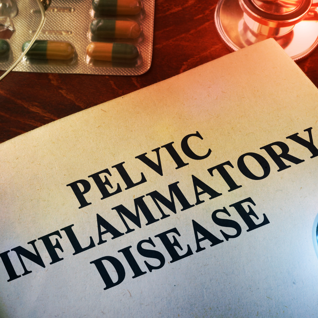Kenali-Radang-Panggul-Infeksi-Reproduksi-Wanita-yang-Sering-Diabaikan.png